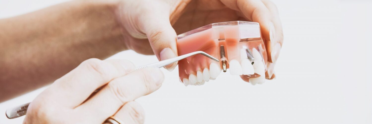 Top Peabody dentist offering general and cosmetic dental services for adults and children including implants, Invisalign, teeth whitening, crowns, root canals, dentures, deep cleaning, emergency services, full mouth rehabilitation. Accepting MassHealth and most major insurances.